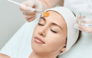 Chemical Peels Arlington VA